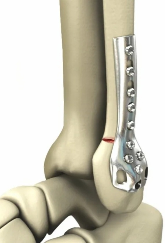 Фото не моё, с интернета