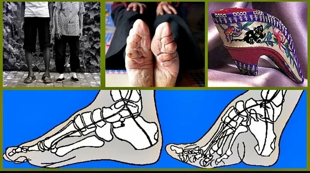 Принцип работы лотосовых ножек.