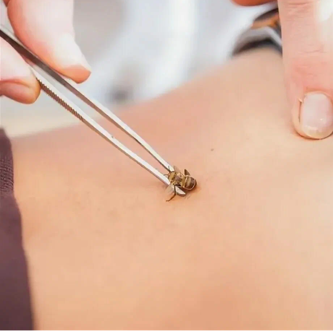 Процесс ужаливания пчелой