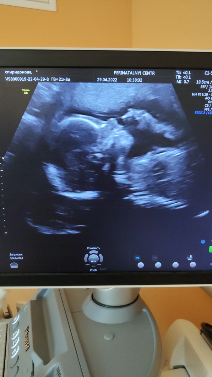 На скрининге