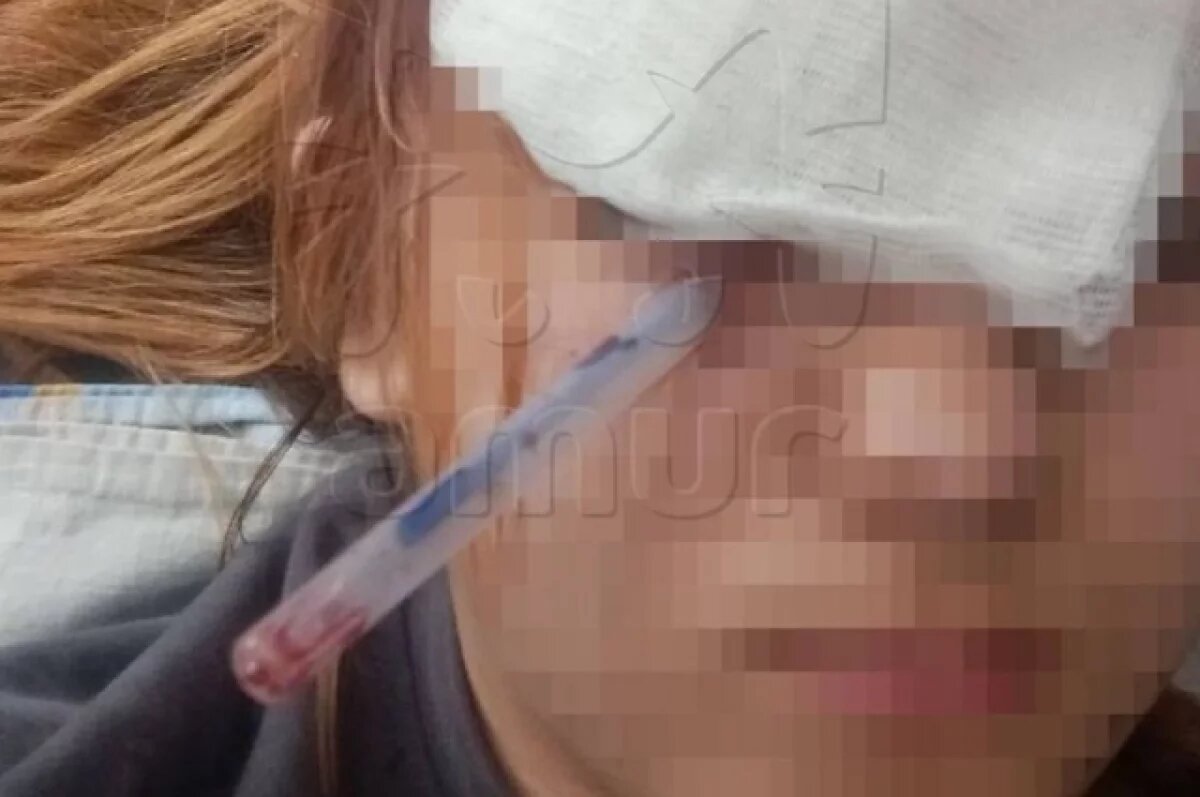    Ей была успешно проведена операция, в ходе которой глаз не пострадал