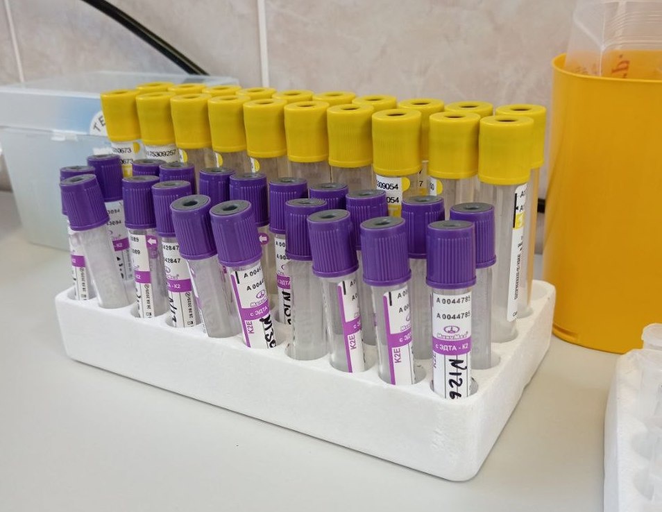 Подготовка материала для исследования. Источник: Сколтех