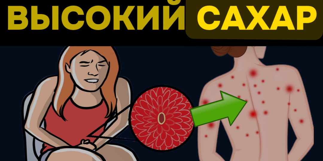 7 сигналов вашего тела, которые кричат: проверьте сахар сейчас