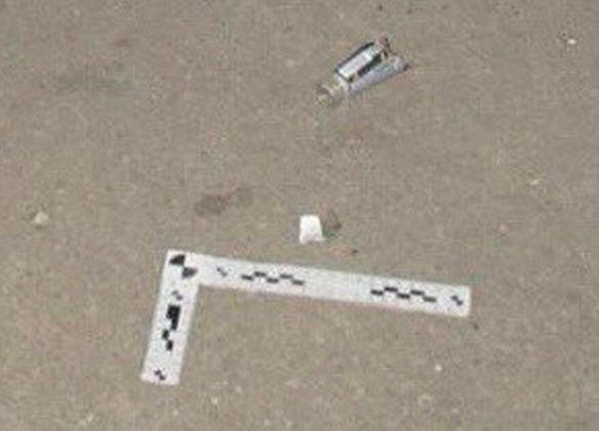 Оставшиеся шрамы можно убрать только с помощью операции