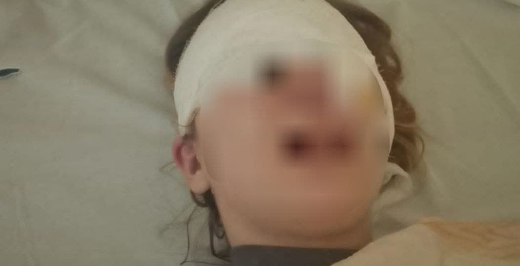 Школьник зверски воткнул ручку в глаз однокласснице в Приморье