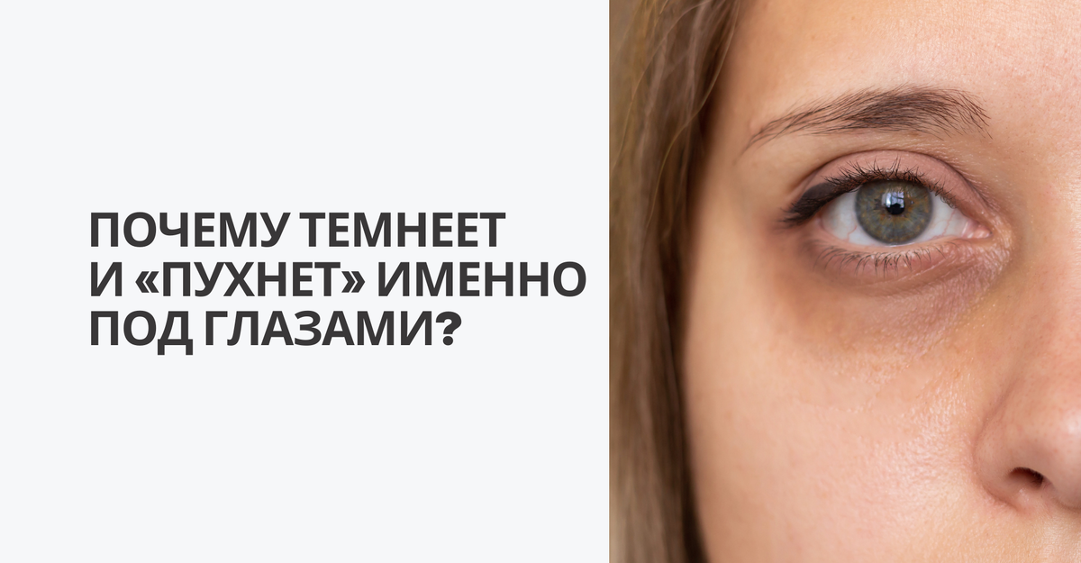 Почему темнеет и «пухнет» именно под глазами?