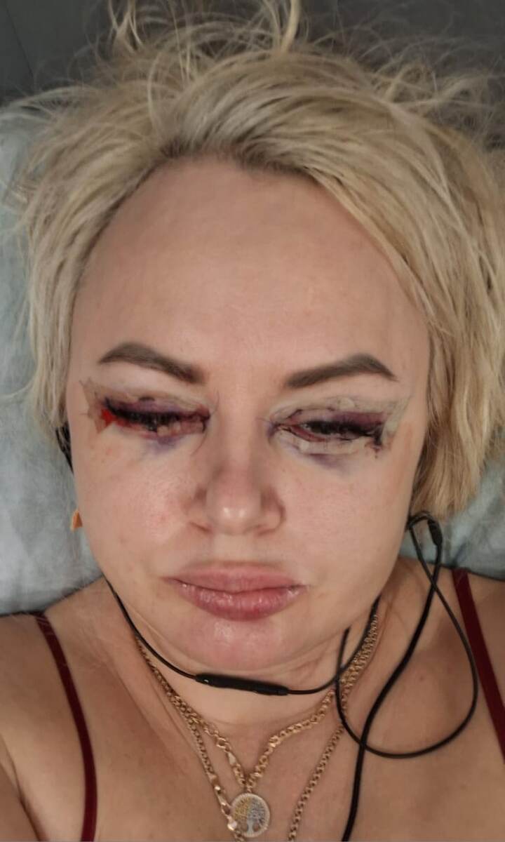 Дома на следующей день после операции.