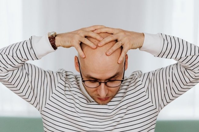    лысина мужчина облысение