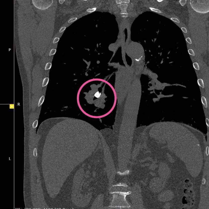 Фото: РКБ Татарстана