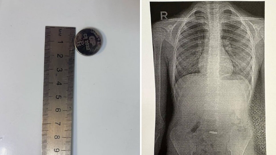 Фото: Telegram-канал ГБУЗ ГБ №1 Новороссийска