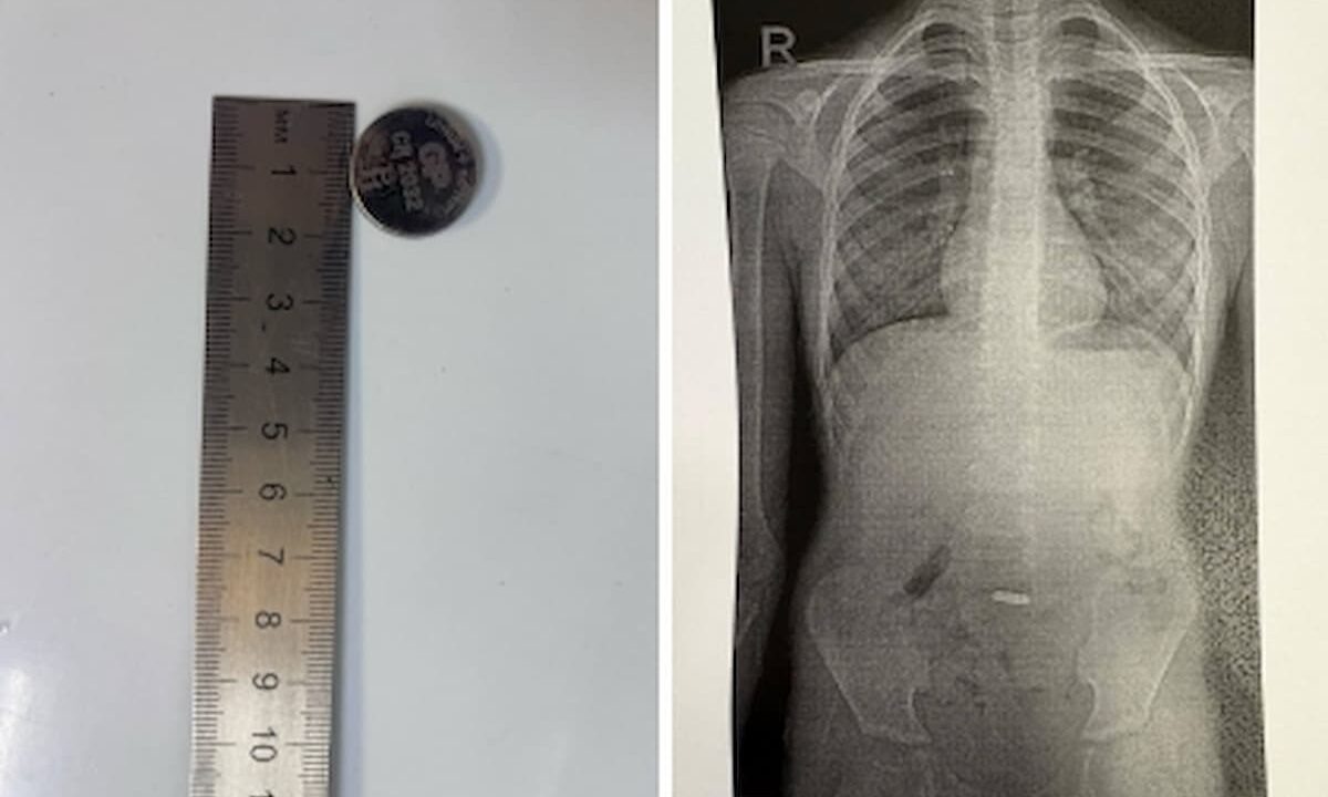    Фото t.me/gorbolnica1nvrsk