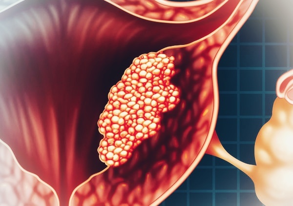 Изменённое изображение для оформления статьи 
