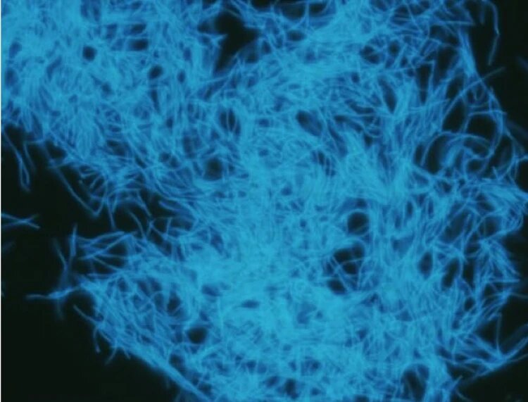 Колония бактерий, производящих метан: их достали с глубины 5 километров.