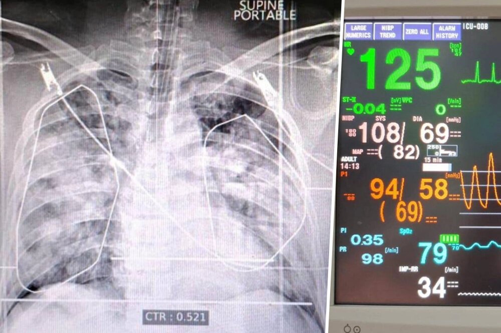    Рентгент-снимок и жизненные показатели Паши Техника. Фото: соцсети