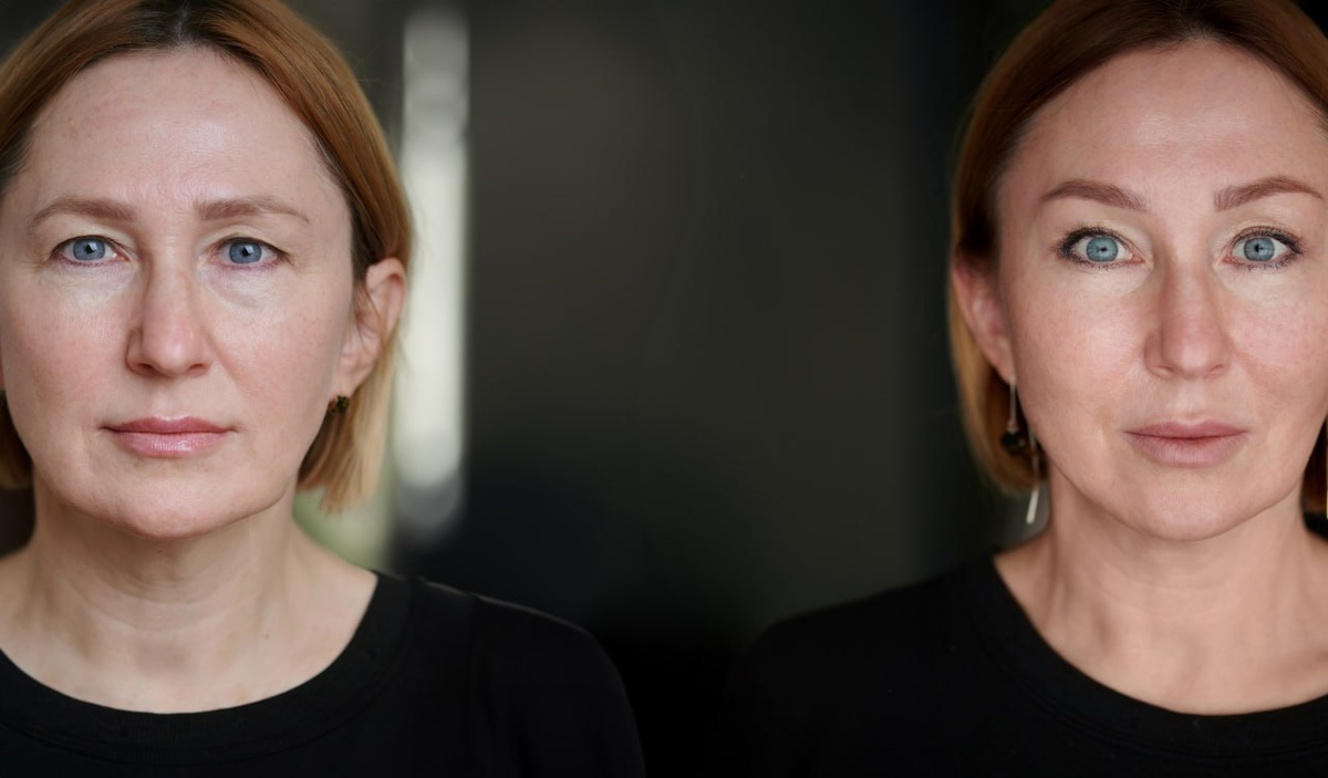 Фото до (слева) / после (справа)