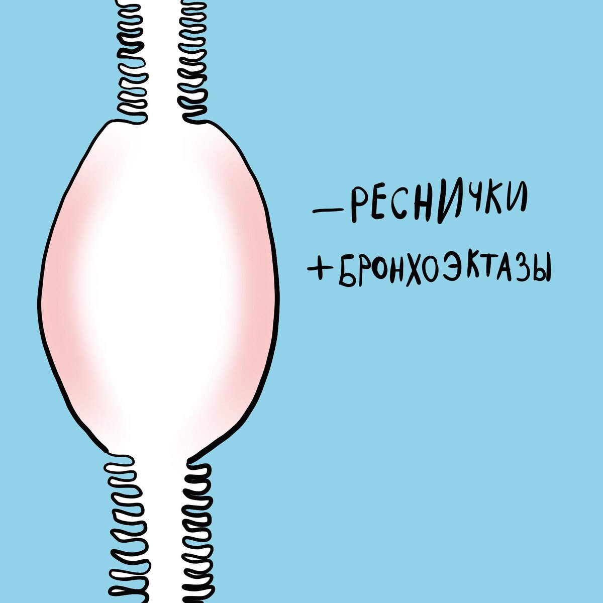 Реснички и бронхоэктазы
