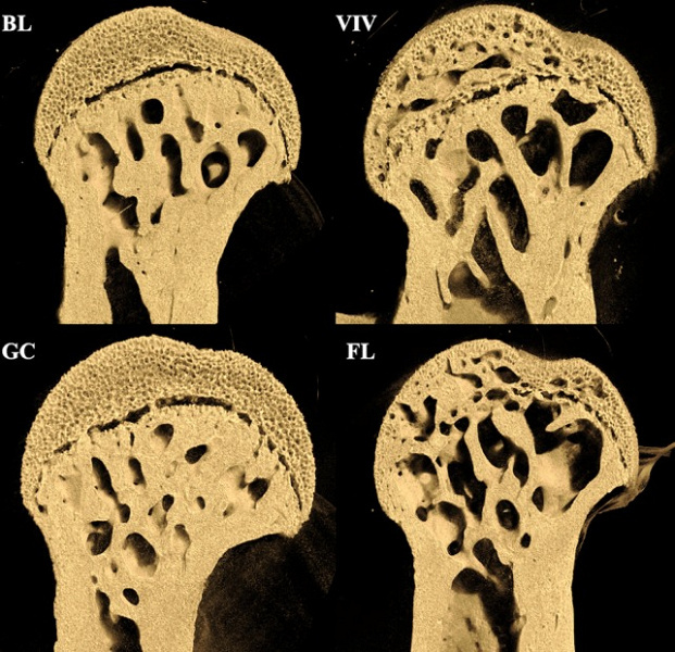 Фото деградации бедренной кости в невесомости www.ixbt.com