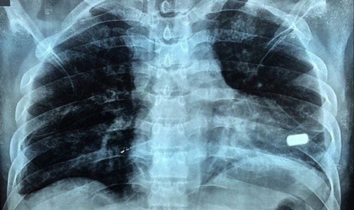 В офисе компании «Гала-оптика» обнаружен мертвый генеральный директор Могилевцев с огнестрельным ранением. Следственные органы проводят проверку, но убийство, по предварительным данным, не рассматривается.