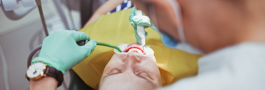 Удаление зубного камня ультразвуком