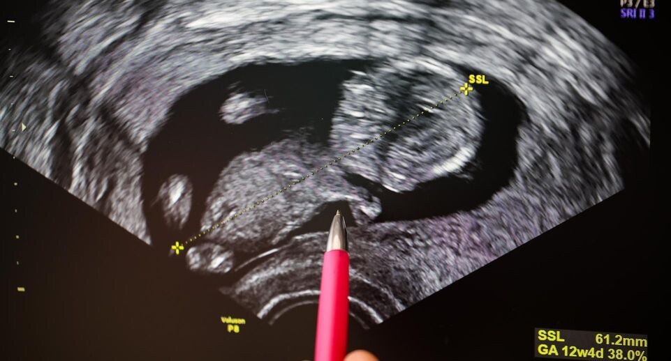    Jan Woitas/dpa / www.globallookpress.com