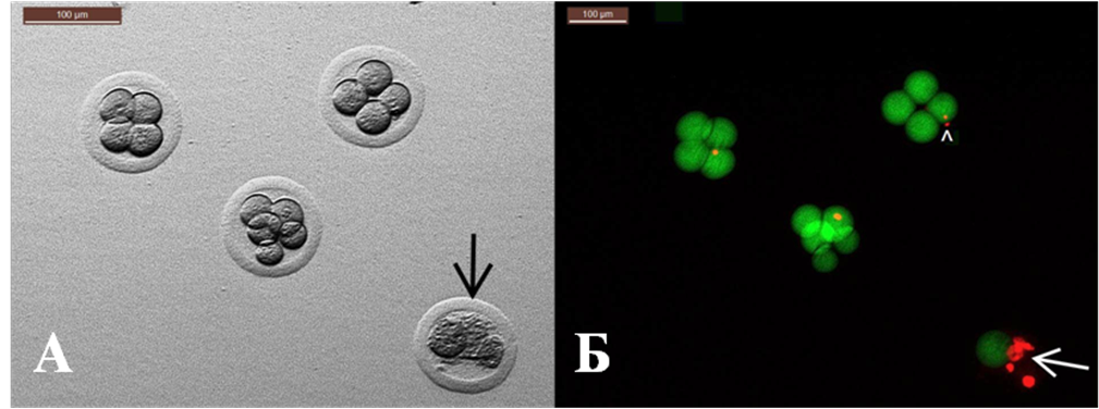Эмбрионы джунгарского хомячка исследованные при помощи световой и флуоресцентной микроскопии на микроскопе M205 FA (Leica microsystems, Германия).
А – 4 эмбриона джунгарского хомячка (стрелкой указан зародыш, в котором имеются мертвые бластомеры);
Б – те же эмбрионы после окраски двумя флуорохромами (FDA + PI) и последующей оценке при помощи флуоресцентной микроскопии. Стрелкой показаны мертвые бластомеры (красное свечение). Отдельные светящиеся красные точки на живых эмбрионах представляют собой полярные тела, которые к этой стадии развития (4 бластомера) являются (естественным образом) мертвыми.
Масштабная полоска = 100 микрон.
