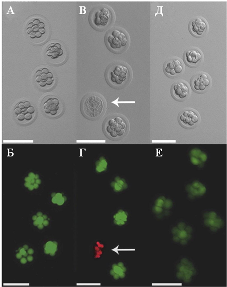 Эмбрионы хомячка Кэмпбелла подвергавшиеся замораживанию и оттаиванию, и контрольные (не подвергавшиеся этим процедурам) исследованные при помощи световой и флуоресцентной микроскопии на микроскопе M205 FA (Leica microsystems, Германия).
Белыми стрелками показаны мертвые бластомеры.
Верхний ряд (А, В, Д) – световая микроскопия.
Нижний ряд (Б, Г, Е) – флуоресцентная микроскопия тех же самых эмбрионов. Окраска двумя флуорохромами: FDA + PI.
Зеленое свечение – живые клетки. Красное свечение – мертвые клетки.
(А, Б) – контрольная группа;
(В, Г) – эмбрионы замороженные с ЭГ в качестве криопротектора;
(Д, Е) – эмбрионы замороженные с ЭГ + сахароза в качестве криопротекторов.
Масштабная полоска = 100 микрон.
