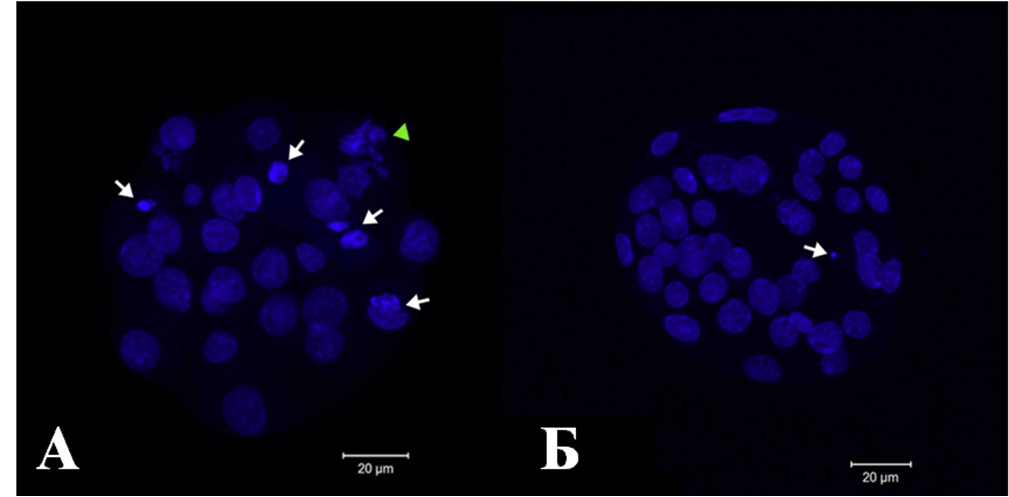 Препараты бластоцист хомячка Кэмпбелла после их криоконсервации и последующего культивирования in vitro в течение 48 часов.
Окраска DAPI, флуоресцентная микроскопия.
А – культивирование в среде R1ECM;
Б – культивирование в среде R1ECM с добавлением GM-CSF (2 нг/мл).
Стрелками показано фрагментации ядер. Треугольник указывает на веретено деления.
Масштабная полоска = 20 микрон. 
