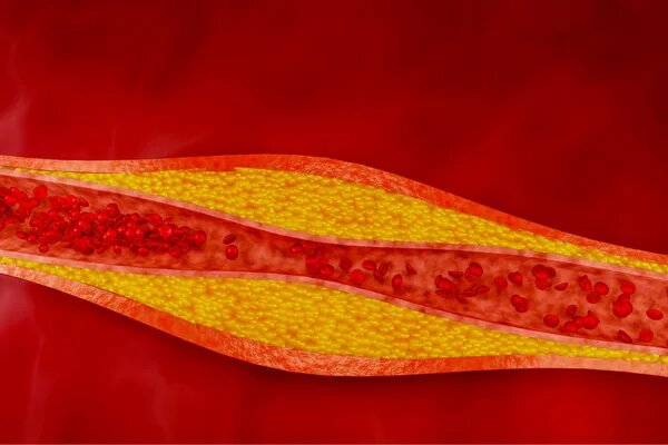    Chinnachart Martmoh via Getty