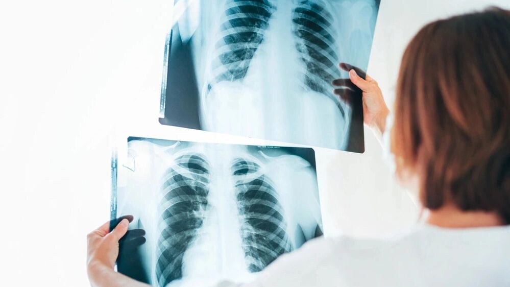    Фото: Soloviova Liudmyla/Shutterstock/Fotodom