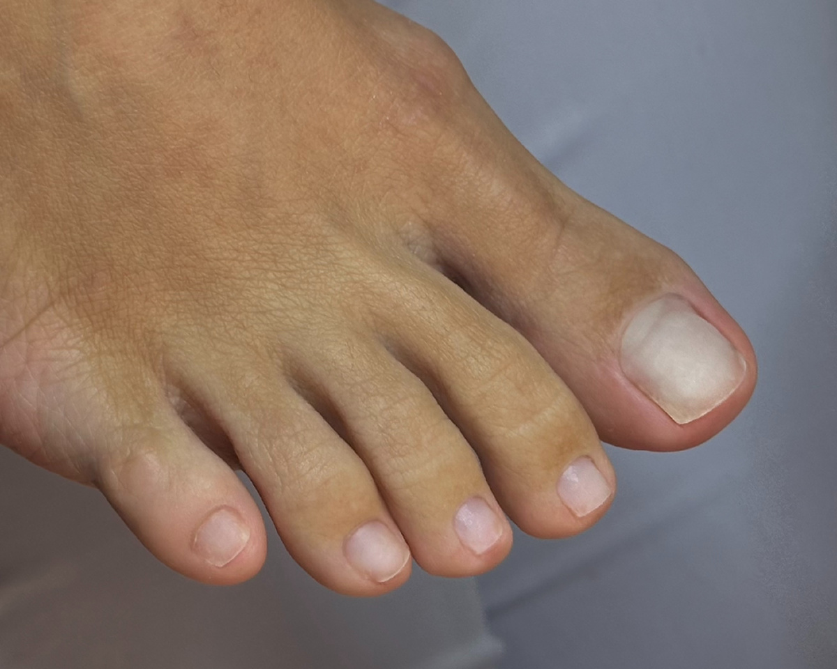 профессиональный педикюр без покрытия