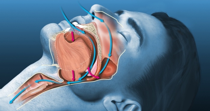 Картинка взята из Яндекс картинок.