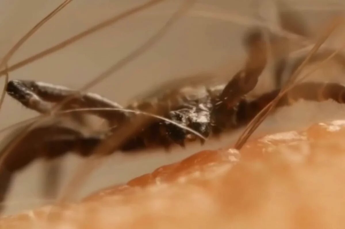    Новосибирский Минздрав: иммуноглобулин не дает гарантий от энцефалита