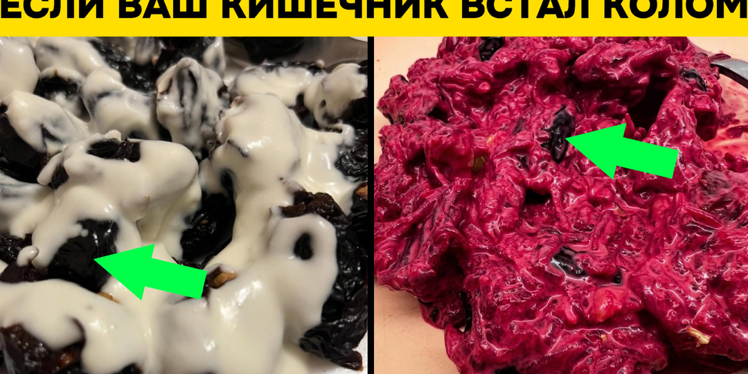 После 45 кишечник встал колом? 5 продуктов, которые вернут лёгкость и зарядят энергией
