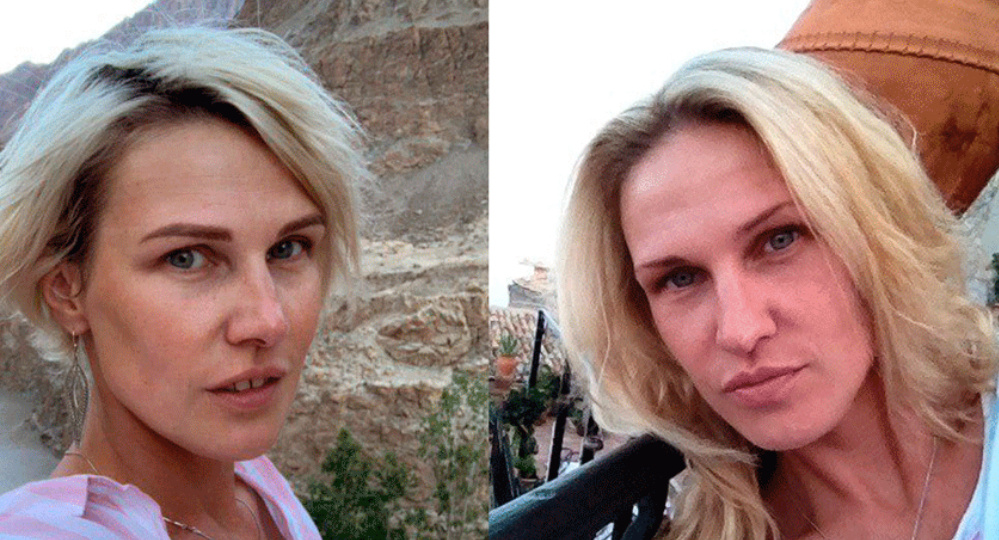 Колоть нельзя фейс-фитнес