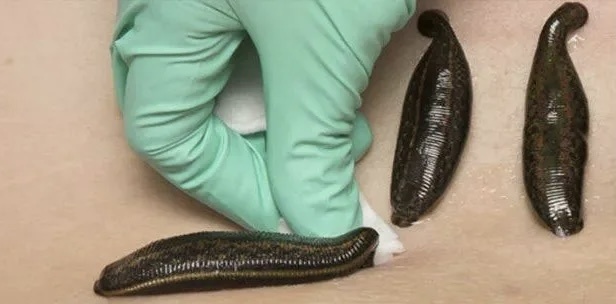 Улучшает микроциркуляцию в зонах, где нарушено кровоснабжение 