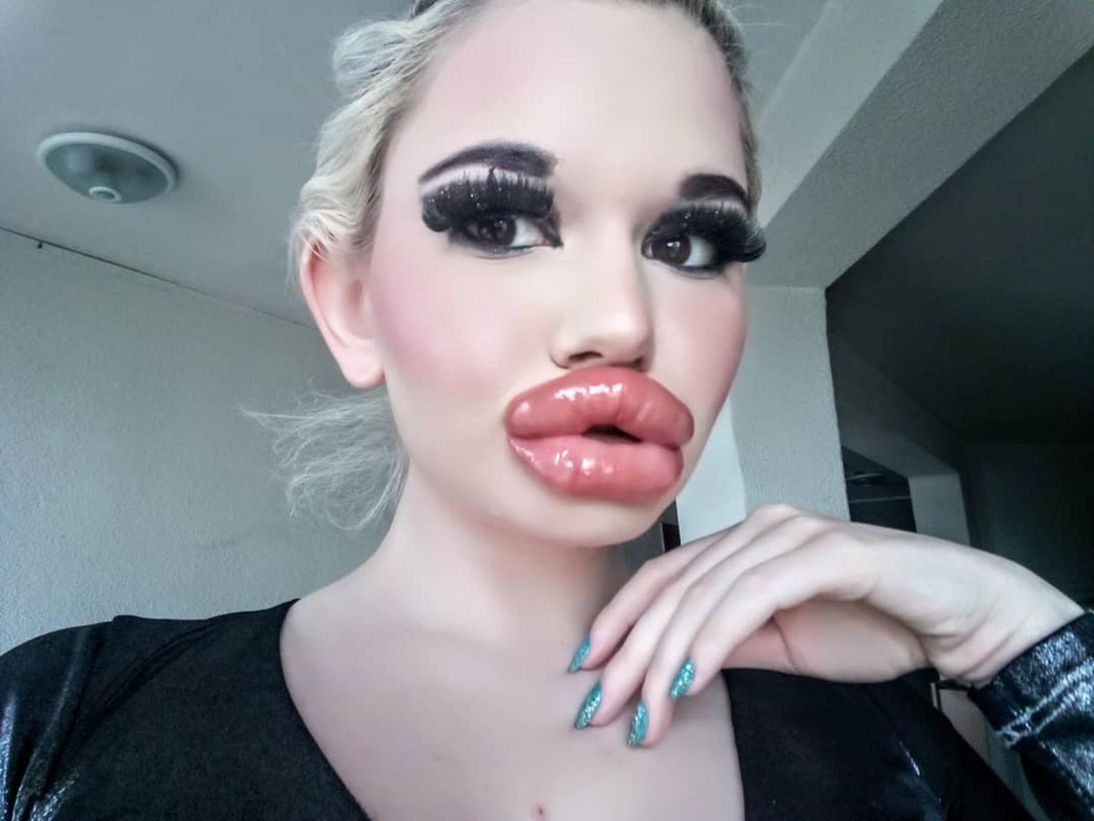 Мужское мнение о том, стоит ли женщине накачивать губы 