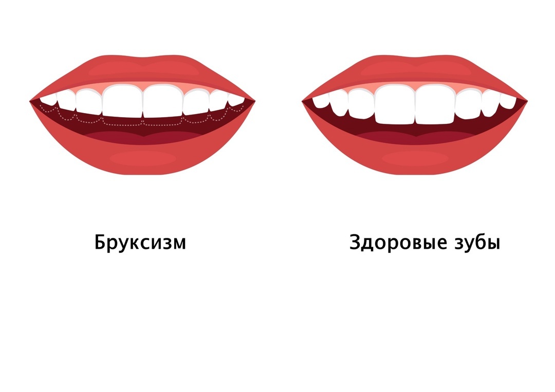 -1-2
