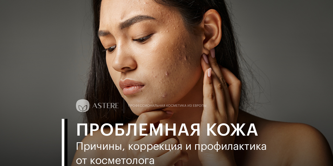 Проблемная кожа: причины, коррекция и профилактика от косметолога