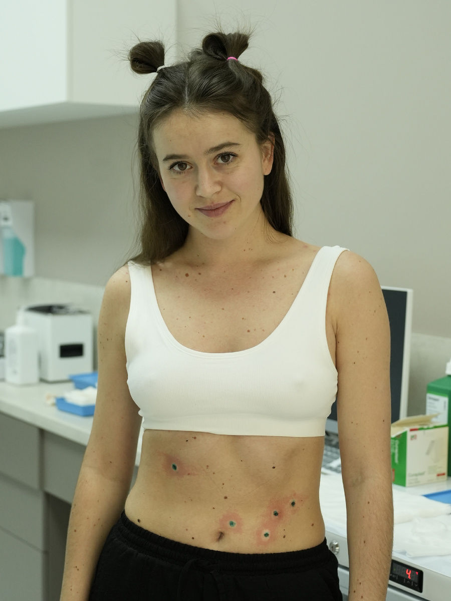 После удаления