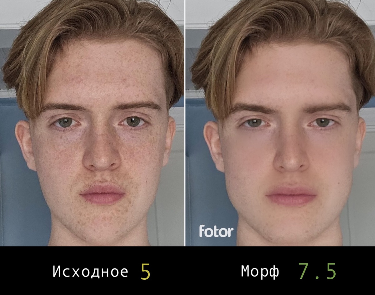 из нормиса в преттибоя