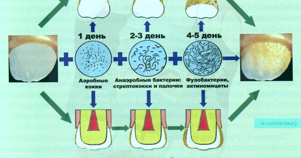 Немного о механизме образования зубных отложений.