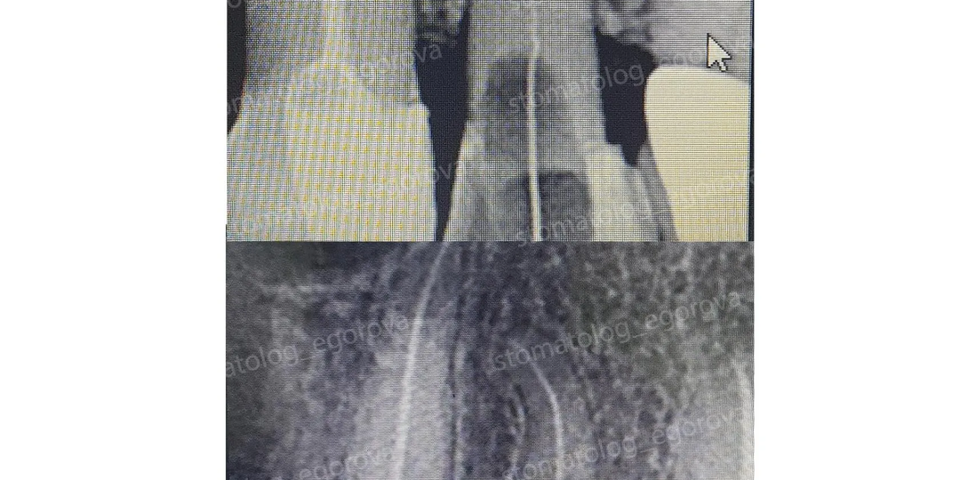 Эндодонтия