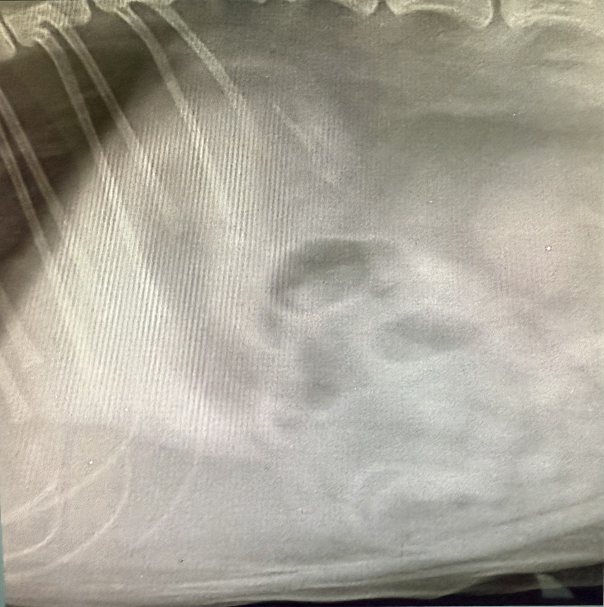 ИТ на рентгене. 