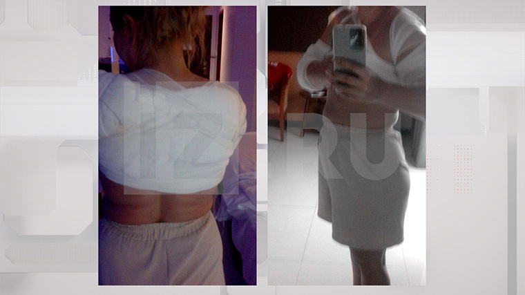    Анастасии не повезло оказаться на катере, а не на пляже, в момент взрыва. Фото: ИЗВЕСТИЯ