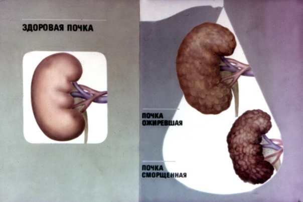 Из открытых источников