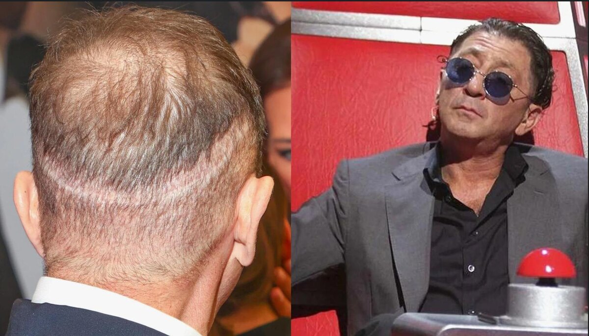 Григорий Лепс на шоу "Голос"