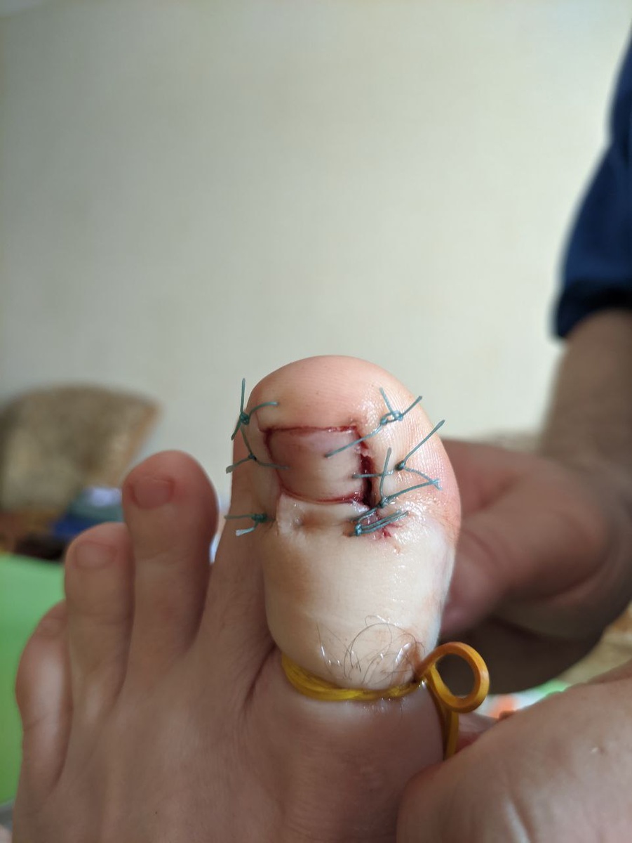 Обещаю, дальше не будет страшнее :)