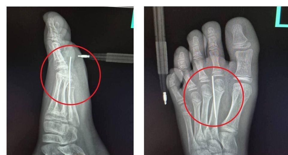    Пресс-служба Министерства здравоохранения Московской области