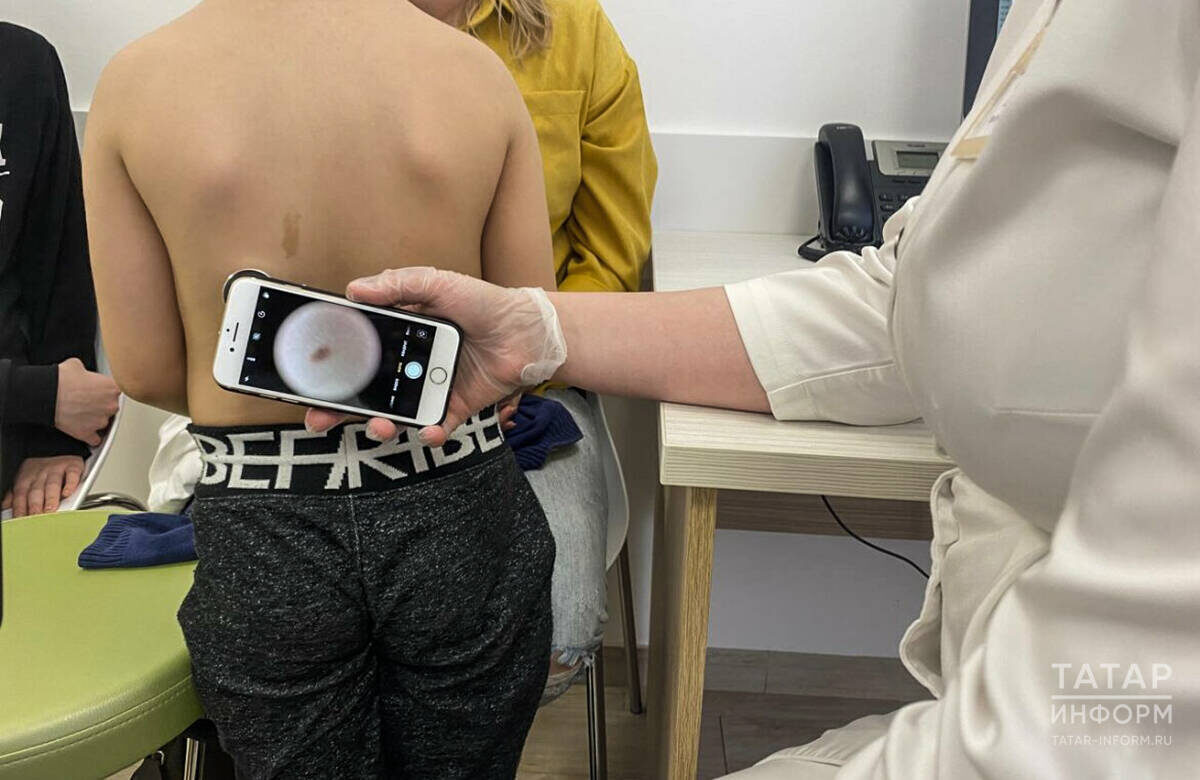 На вооружении медицины сегодня современные методы диагностики рака кожиФото: © «Татар-информ»