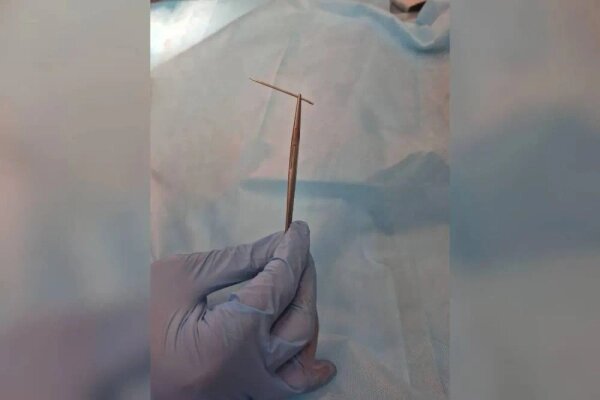 10-летний мальчик наступил на одну из иголок. Фото © Предоставлено Life.ru